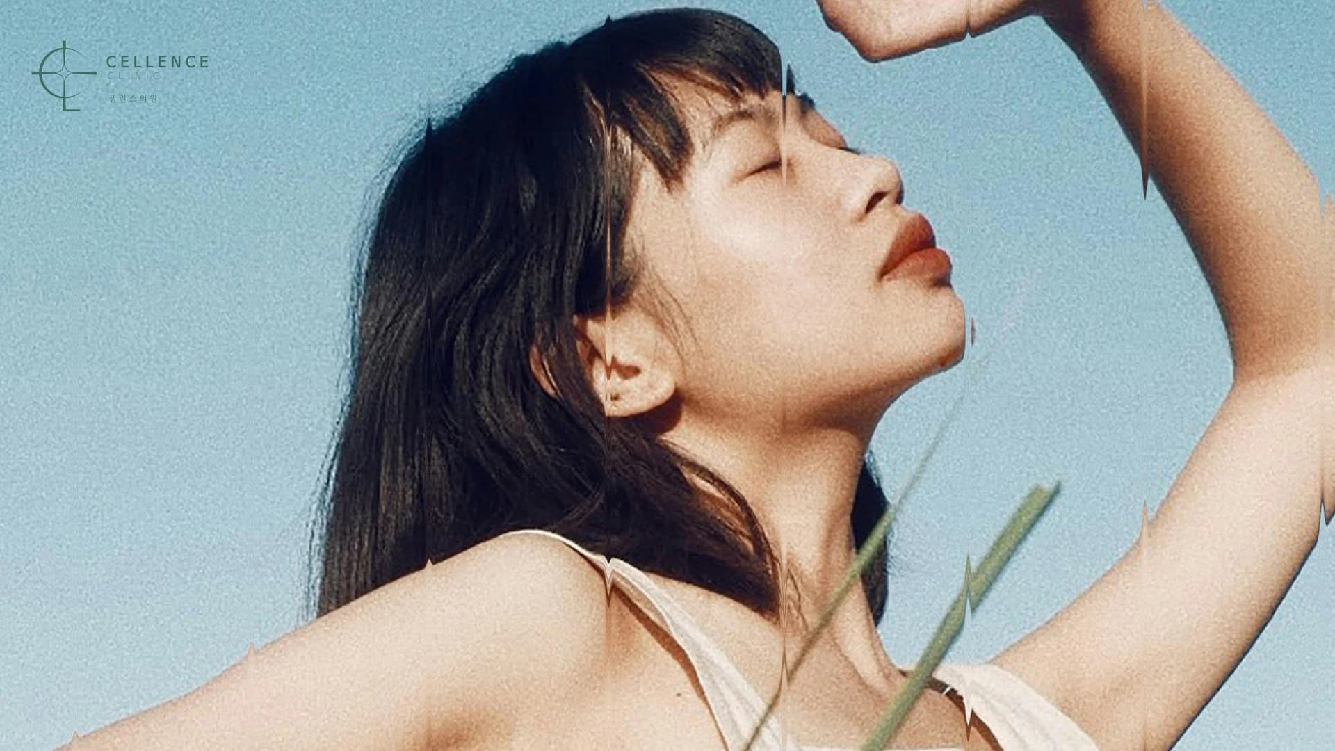다한증 보툴리눔 톡신(땀 주사) 썸네일